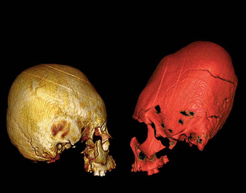গবেষণায় দাবি, মৃত্যুর আগে তিন কিশোর একই খাবার খেয়েছে দীর্ঘ দিন। তারা থাকতও একই জায়গায়। তাদের কবর দেওয়া হয়েছিল ঘোড়া ও শূকরের হাড় সমেত। তবে অজ্ঞাত রয়ে গিয়েছে তাদের অকালমৃত্যুর কারণ। অনুমান, হয়তো তাদের বলি দেওয়া হয়েছিল। অথবা প্লেগের মতো কোনও মারণ মহামারীতে মৃত্যু হয়েছিল। বলপ্রয়োগ করে হত্যার কোনও প্রমাণ পাওয়া যায়নি।