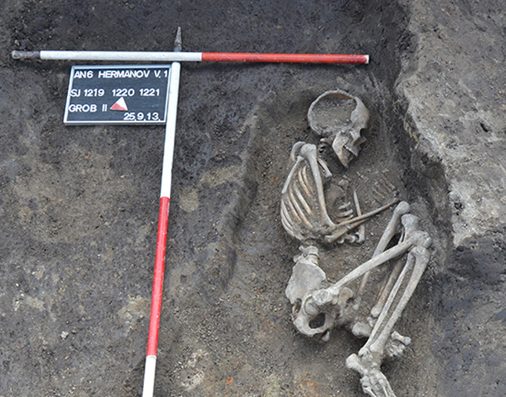 ইউরোপের অন্য অংশেও উদ্ধার হয়েছে এসিডি স্কাল বা বিকৃত খুলি। তাদের মধ্যে মহিলাদের করোটির অনুপাতই বেশি। এই বিষয়ে আরও গবেষণায় আরও নতুন নতুন তথ্য জানা যাবে বলে দাবি ইতিহাসবিদদের। কারণ, এই রীতি কারা ইউরোপে এনেছিল, তার সঙ্গে জড়িয়ে আছে মাইগ্রেশনের অজানা তথ্য।