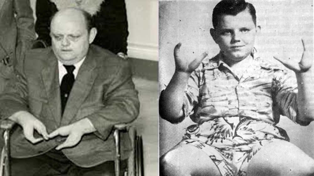 অন্যদিকে, গ্র্যাডি তাঁর পরিবারের মতো সমাজেও আরও বেশি ‘ঘৃণ্য’ বলে চিহ্নিত হন। বিতৃষ্ণার মাত্রা এতটাই তীব্র ছিল, অন্ত্যেষ্টির সময় ‘লবস্টার বয়’-এর কফিনবহনের জন্যও পরিচিত কেউ রাজি হননি। (ছবি: ফেসবুক ও শাটারস্টক)