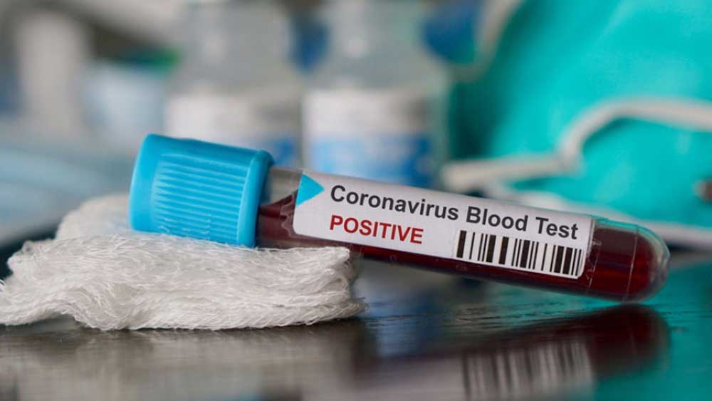 Political Gatherings may boost the infection rate of Coronavirus, says Health Officials