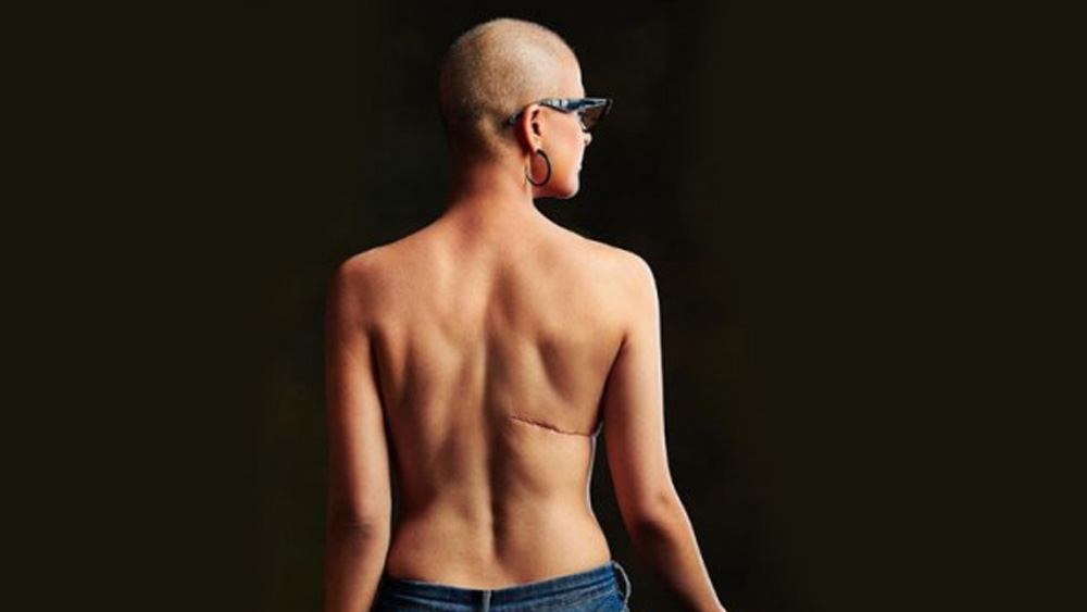 এক সময় ব্রেস্ট ক্যানসারের বিরুদ্ধে লড়াইকেও জীবনের যাত্রাপথের অঙ্গ হিসেবে মেনে নিয়েছেন আয়ুষ্মান-তাহিরা। অভিযোগ বা বিলাপের পথে না গিয়ে মুখোমুখি হয়েছে সত্যের। তাতেই হয়তো সংগ্রামের রসদ পেয়েছেন। কেমোথেরাপি চলার সময়ে তাহিরা নিজের ছবিও শেয়ার করেছেন নিয়মিত।