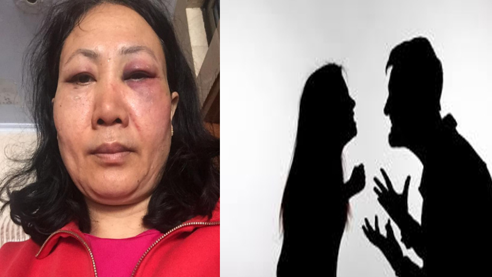 প্রাক্তন হকি খেলোয়াড় সূরজ নিজে পশ্চিম রেলের অফিস সুপার পদে কর্মরত। গত নভেম্বরে পঞ্জাবের কপূরথালার সুলতানপুর লোধি এলাকায় রেলের একটি প্রতিযোগিতা পরিচালনার দায়িত্বে ছিলেন তিনি। অভিযোগ, সে সময় সূরজকে বেঁধে রেখে টানা তিন ঘণ্টা ধরে নৃশংসভাবে মারধর করেন শান্তাকুমার। সে সময় শান্তাকুমার নিজে অসংলগ্ন অবস্থায় ছিলেন বলেও অভিযোগ।