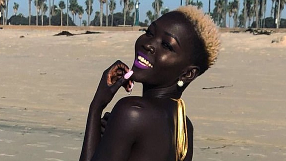 এই বক্রোক্তি শুনতে শুনতেই বড় হওয়া। আজ ন্যাকিম প্রথম সারির মডেল। মডেলিং করেছেন আন্তর্জাতিক মানের ব্র্যান্ডের জন্য। যে রঙের জন্য বিদ্রূপ সহ্য করতে হত, এখন সেটাই তাঁর তুরূপের তাস।