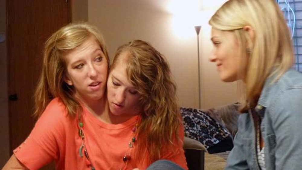 দুটো শিশুই জোড়া। বাইরে থেকে তাঁদের শুধু মাথা দুটো আলাদা। সাধারণত এ রকম সন্তান খুব বেশি দিন বাঁচতে পারে না। চিকিৎসকেরা প্যাটিকে জানিয়েছিলেন, অস্ত্রোপচার করে তাঁদের আলাদা করে দেওয়া হবে।