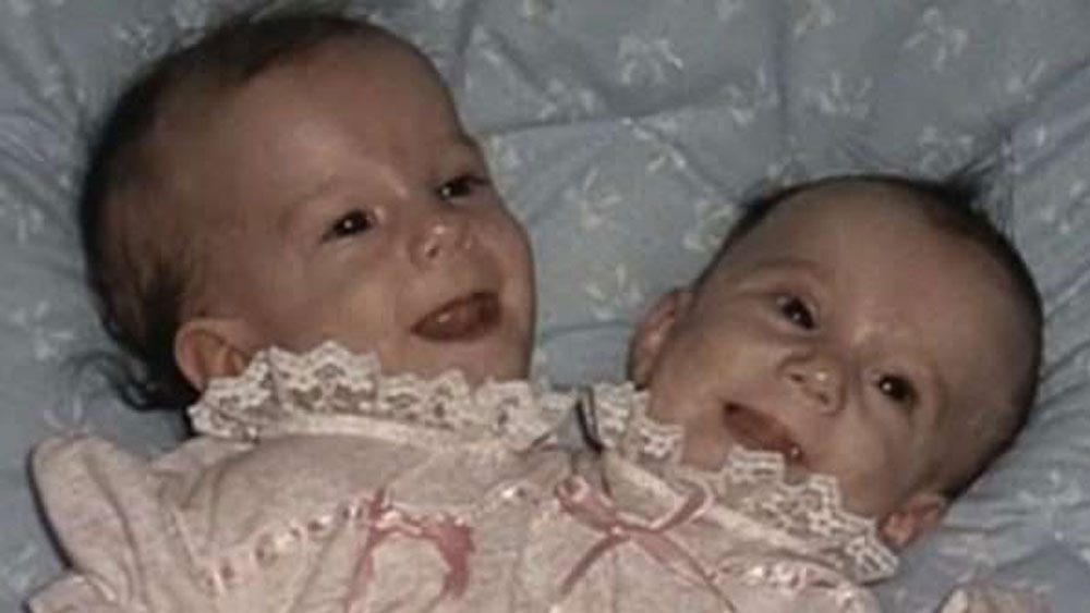 তবে সে ক্ষেত্রে যে কোনও একজনকে বাঁচাতে পারবেন তাঁরা। মায়ের মন তাতে রাজি হয়নি। কোনও সন্তানকেই প্যাটি হারাতে চাইছিলেন না। স্বামীর সঙ্গে মিনেসোটার প্রত্যন্ত ফার্মে দুই সন্তানকে নিয়ে তাঁরা বসবাস শুরু করেন। সংক্রমণ এড়াতেই প্রত্যন্ত জায়গা বেছে নিযেছিলেন তাঁরা।