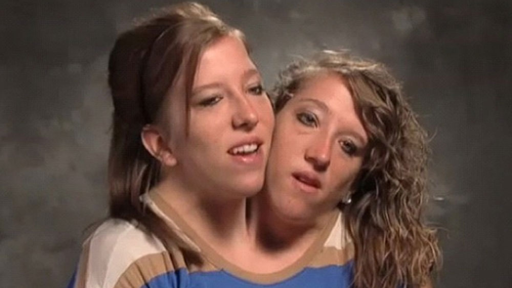 সারা বিশ্ব তাঁদের একনামে চেনে। এমন জোড়া সন্তানরা ছোটবেলায় লাইমলাইটে থাকে ঠিকই, কিন্তু বড় হয়ে ওঠার সঙ্গে বেশির ভাগই নিজেদের হারিয়ে ফেলে। সমাজে কৌতূহলের শিকার হয়ে বেশির ভাগই জীবনের সঙ্গে মানিয়ে চলতে পারেন না। সে সবের বিরুদ্ধে গিয়ে অ্যাবি-ব্রিটনি কিন্তু তাঁদের আলাদা পরিচয় গড়ে তুলেছে।