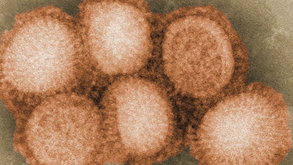 এশিয়াটিক ফ্লু: হংকং ফ্লু ছিল সাধারণ ইনফ্লুয়েঞ্জা ভাইরাসেরই একটা ধরন। ভাইরাস তাদের জেনেটিক পরিবর্তন ঘটিয়ে ক্রমে আরও ভয়াবহ আকার নিয়ে থাকে। এই এশিয়াটিক ফ্লু বা রাশিয়ান ফ্লু-ও তাই।