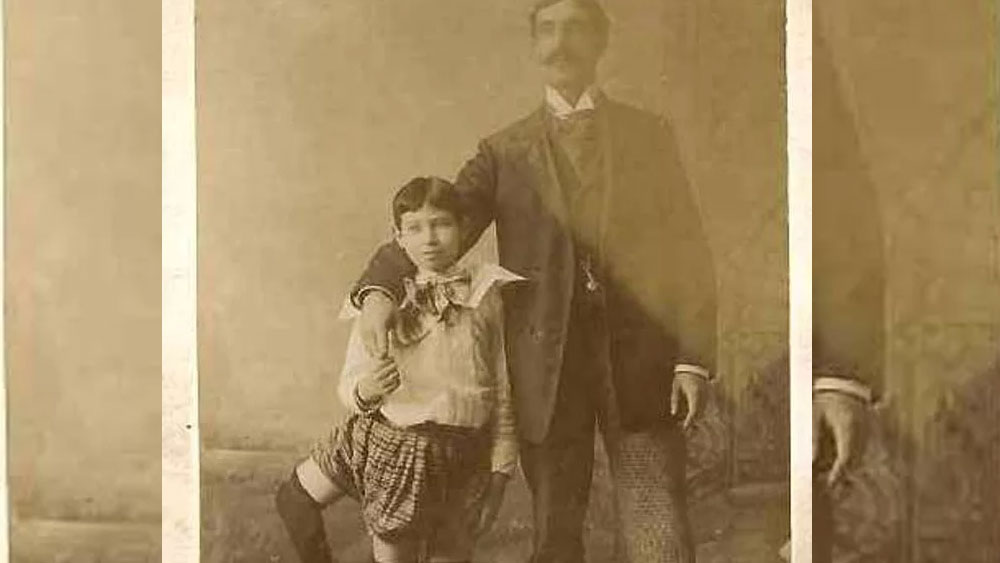 তাঁর শরীরে তিনটে পা, চারটে পায়ের পাতা, ১৬টা আঙুল এবং দু’টো সক্রিয় যৌনাঙ্গ ছিল। সারা বিশ্বে তিনি ‘থ্রি লেগড ম্যান’ হিসাবে পরিচিত হয়ে যান। তৃতীয় পা এমন ভাবেই তাঁর মেরুদণ্ডের সঙ্গে জুড়ে ছিল যে, তা অস্ত্রোপচার করলে ফ্রাঙ্কের প্রাণের ঝুঁকি থেকে যেত।