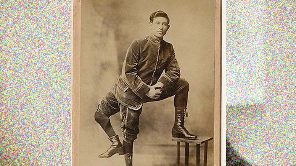 নিজের এই অস্বাভাবিক দৈহিক বৈশিষ্ট্য ফ্রাঙ্ককেও ভিতরে ভিতরে কুরে খাচ্ছিল। যত বড় হচ্ছিলেন, যত বুঝতে শিখছিলেন, ততই মানসিক জড়তা তৈরি হচ্ছিল তাঁর মধ্যে।