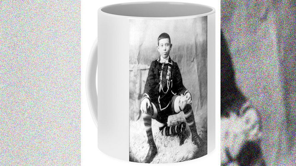 সঙ্গে ছিল তাঁর দুর্দান্ত রসিকতা এবং তীব্র বুদ্ধি। ক্রমে শারীরিক প্রতিকূলতা ছাপিয়ে মানুষ ফ্রাঙ্ককে ভালবেসে ফেলেন দর্শকেরা।