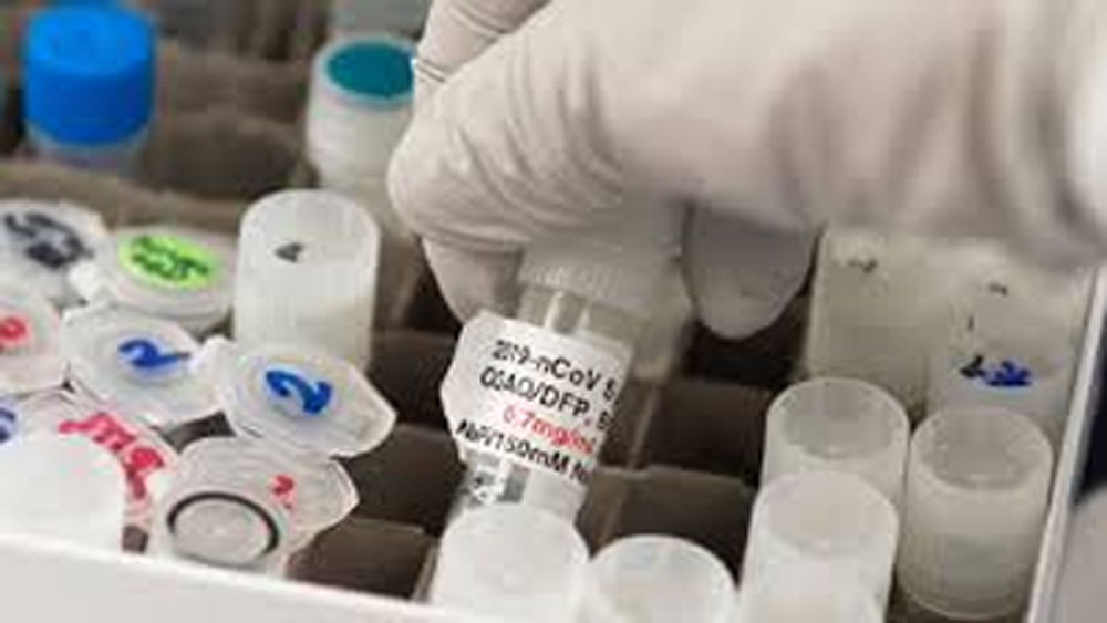 Coronavirus in North Bengal: COVID-19 test heald at North Bengal