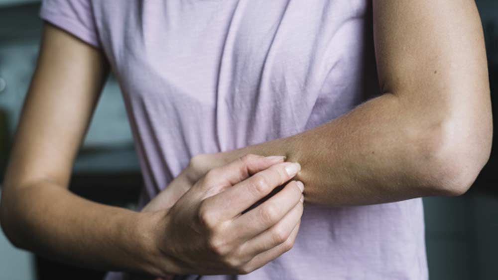 এই লক্ষণে হাত বা পায়ের একটা নির্দিষ্ট অংশ জুড়ে ফ্রস্ট বাইটের মতো হয়। প্রথম প্রথম তা লালচে ফোস্কার মতো আকার নেয়। সেই অংশের রংও বদলে বদলে যায়। চুলকানিও থাকে। পায়ের পাতা, হাতের তালু, হাত-পায়ের আঙুলেই এই সমস্যা বেশি হয়। গবেষকদের দাবি, হাত-পায়ের সূক্ষ্ম সূক্ষ্ম রক্তবাহী নালির মধ্যে আণুবীক্ষণিক রক্তের ডেলা জমে এই সমস্যা হচ্ছে। তবে এ নিয়ে আরও অনেক গবেষণা প্রয়োজন বলেও মনে করেন তাঁরা।