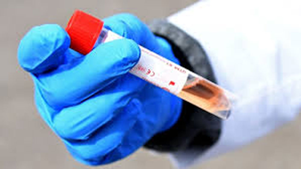 Coronavirus in north bengal: four new covid patient found 