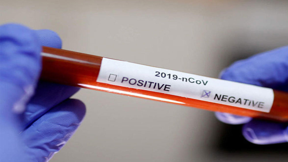 Coronavirus in Midnapore: The report of 16 people comes negative