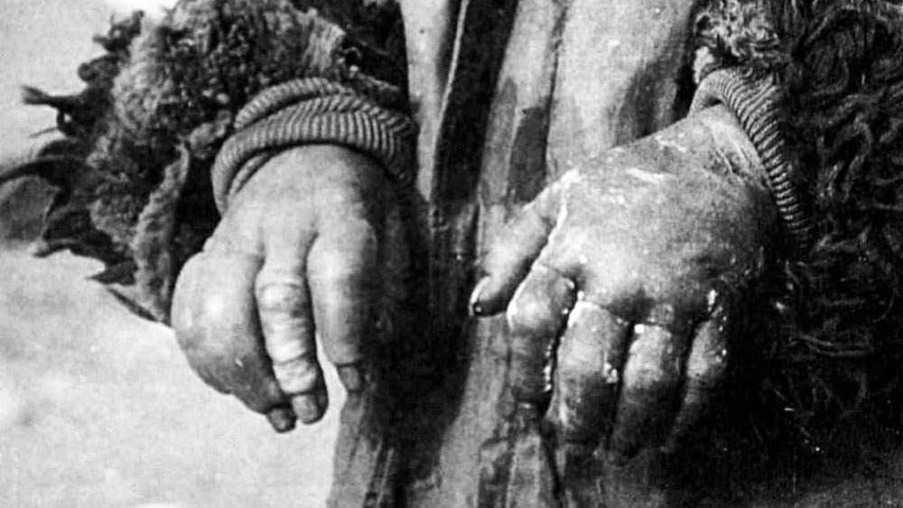 কী ভাবে গবেষণা করা হত এই ‘টর্চার হাউস’-এ? এই গবেষণার মধ্যে ছিল ‘ফ্রস্টবাইট এক্সপেরিমেন্ট’। এই গবেষণায় ব্যবহৃত ব্যক্তির হাত-পা কনকনে ঠান্ডা জলের মধ্যে ডুবিয়ে রাখা হত যত ক্ষণ না তা জমে যায়। তার পর হাত-পায়ে ফুটন্ত গরম জল ঢালা হত। দেখা হত, আলাদা আলাদা তাপমাত্রায় মানুষ শরীরে কী ধরনের প্রভাব পড়ে।