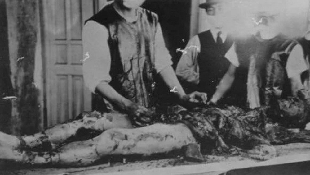 গবেষণার জন্য যুদ্ধবন্দিদের শরীরে ভাইরাস ঢুকিয়ে দেওয়া হত। শরীরের যেখানে যেখানে ভাইরাসের মারাত্মক প্রভাব পড়ত সেই অংশ কেটে বাদ দেওয়া হত। ভাইরাসের মাধ্যমে সংক্রমণ কতটা জোরদার তা এই ধরনের পরীক্ষার মধ্যে দিয়ে দেখা হত।