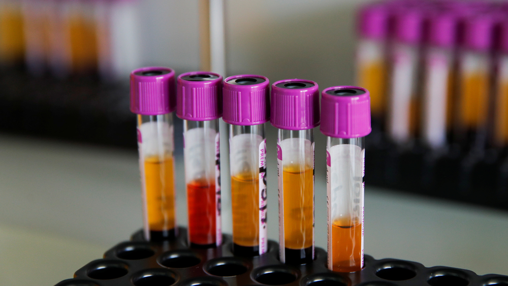 We may not get the vaccine of Coronavirus like HIV said WHO