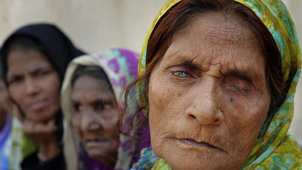 সে দিন অবশ্য অনেকে মৃত্যুকে হার মানিয়ে দিয়েছিলেন বটে। কিন্তু সারাজীবন ধরে বয়ে চলতে হয়েছে সেই যুদ্ধের ক্ষত। গ্যাস দুর্ঘটনার জেরে শারীরিক ভাবে ক্ষতিগ্রস্ত হন সাড়ে পাঁচ লক্ষের বেশি মানুষ। স্থায়ী ভাবে পঙ্গুত্বের শিকার হন ৩ হাজার ৯০০ জন।