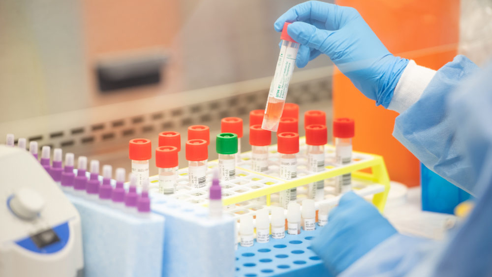 Question on the method of test for many samples being rejected