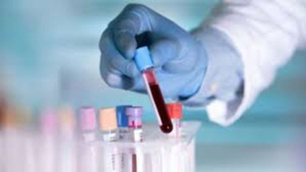 The idea of ​​stopping the process of collecting samples from corpses?