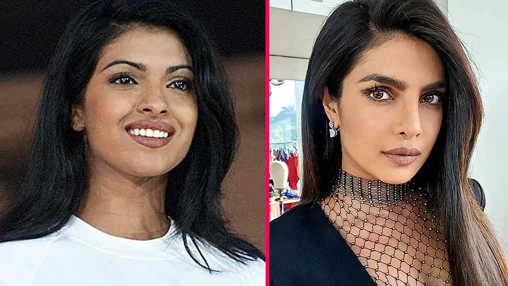 অনেকেই বলেন, নোজ জব করিয়েছেন তিনি। আর স্কিন লাইটনিং? সে দিকেও নাকি হাত বাড়িয়েছেন এই অভিনেত্রী।