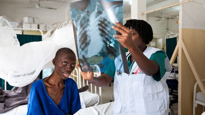 তার পর সারা বিশ্বে ছড়িয়ে পড়তে থাকে এডস। বিংশ শতাব্দীর শেষ দুই দশকে ভয়াবহ আকার ধারণ করেছিল এই প্রাণঘাতী ভাইরাস। এখনও অবধি বিশ্বের প্রায় সাত কোটি মানুষ আক্রান্ত হয়েছেন এই রোগে। প্রায় সাড়ে তিন কোটি মানুষের প্রাণ কেড়েছে এই ভাইরাস। বর্তমানে এই রোগের অনেক ওষুধ বেরিয়েছে। তাই ভাইরাসটি থেকে গেলেও আগের থেকে মৃত্যু হার অনেক কমেছে।