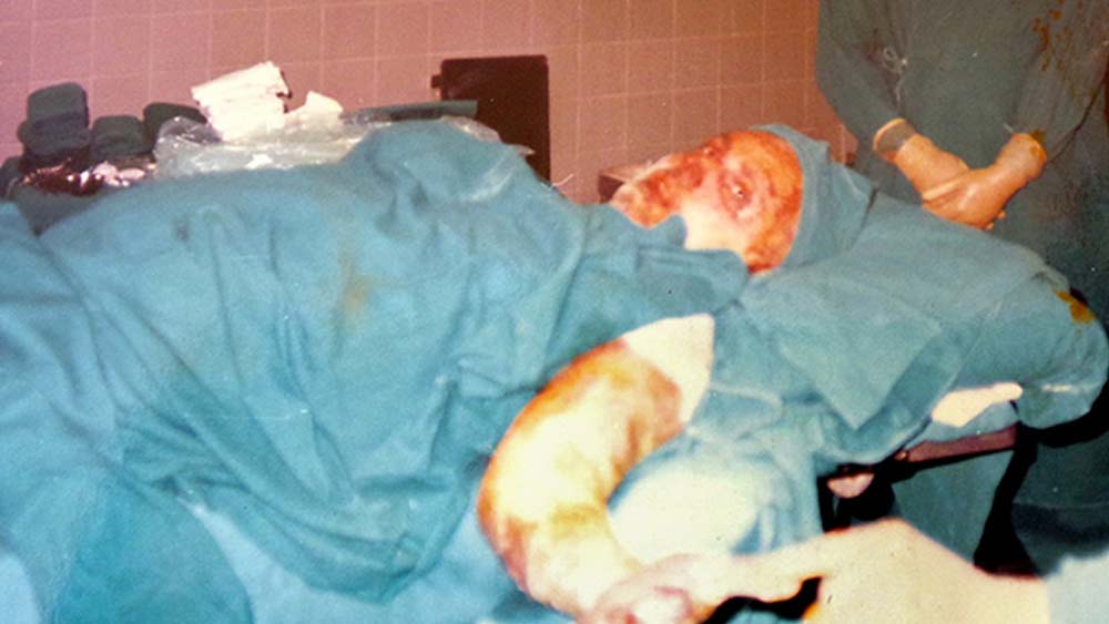 পরিচালক সঞ্জয় নিজে মারাত্মক আহত হন অগ্নিকাণ্ডে। ১৩ মাস হাসপাতালে ভর্তি থেকে ৭৩টি অস্ত্রোপচার সহ্য করতে হয় তাঁকে। আশঙ্কা ছিল, এই ধারাবাহিকের কাজ হয়তো অসম্পূর্ণই থেকে যাবে।