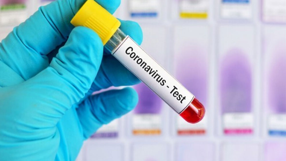 Families of Patients allegedly harassed to get COVID test result