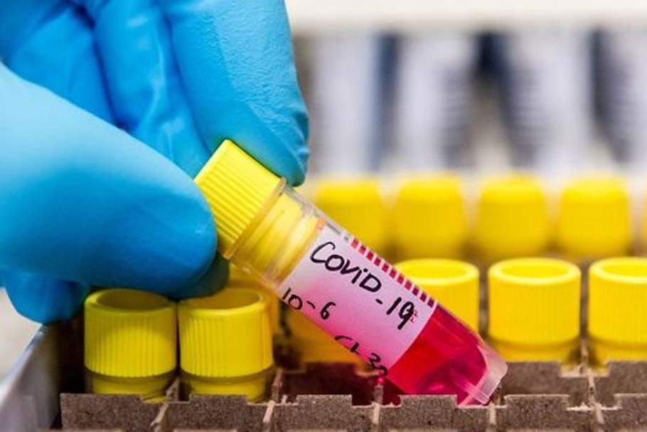 Coronavirus in India: number of daily infection at least 10 times higher than actual number