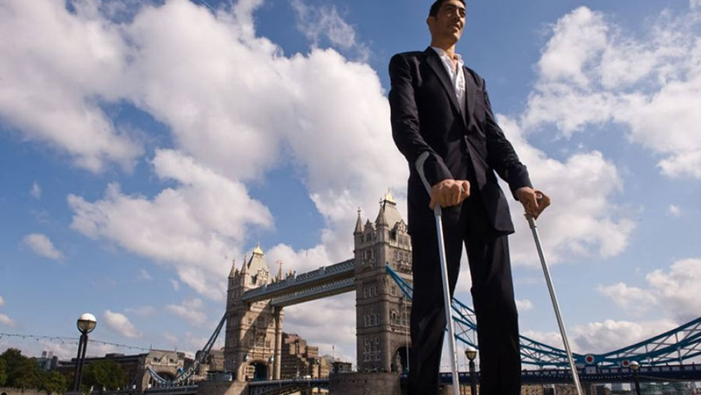 চিকিৎসকের কাছে নিয়ে গিয়ে মা-বাবা জানতে পারেন যে সুলতানের মাথায় একটি টিউমার রয়েছে। টিউমার হয়েছে মাস্টার গ্ল্যান্ড পিটুইটারিতেই।