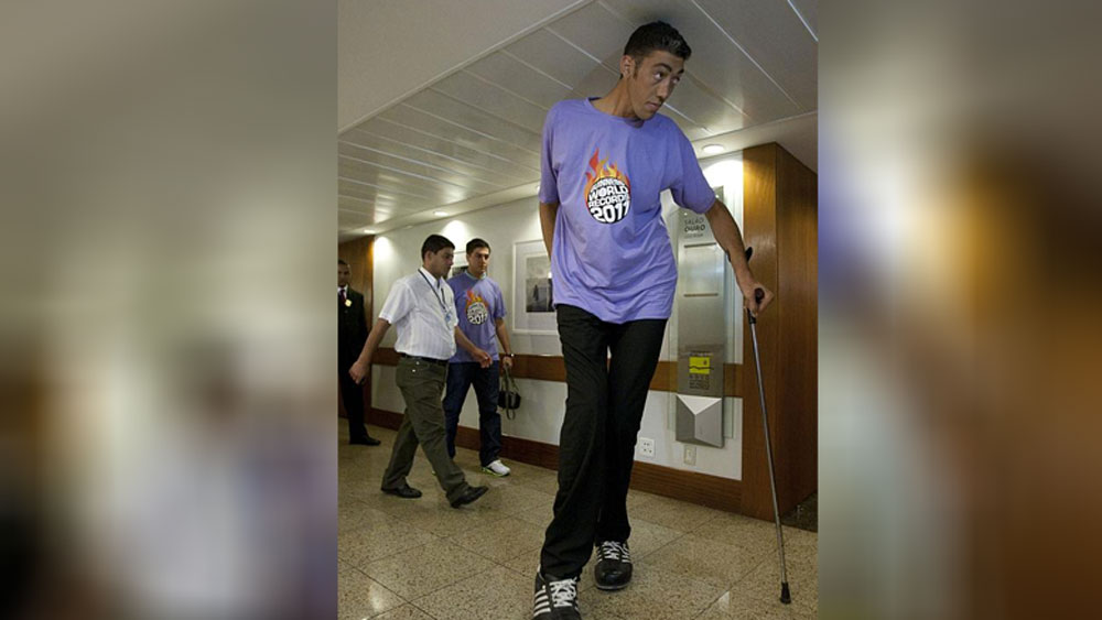 দেহে গ্রোথ হরমোনের পরিমাণ এতটাই বেড়ে যেতে শুরু করে যে যেন লাফিয়ে বাড়তে শুরু করে তাঁর উচ্চতাও।