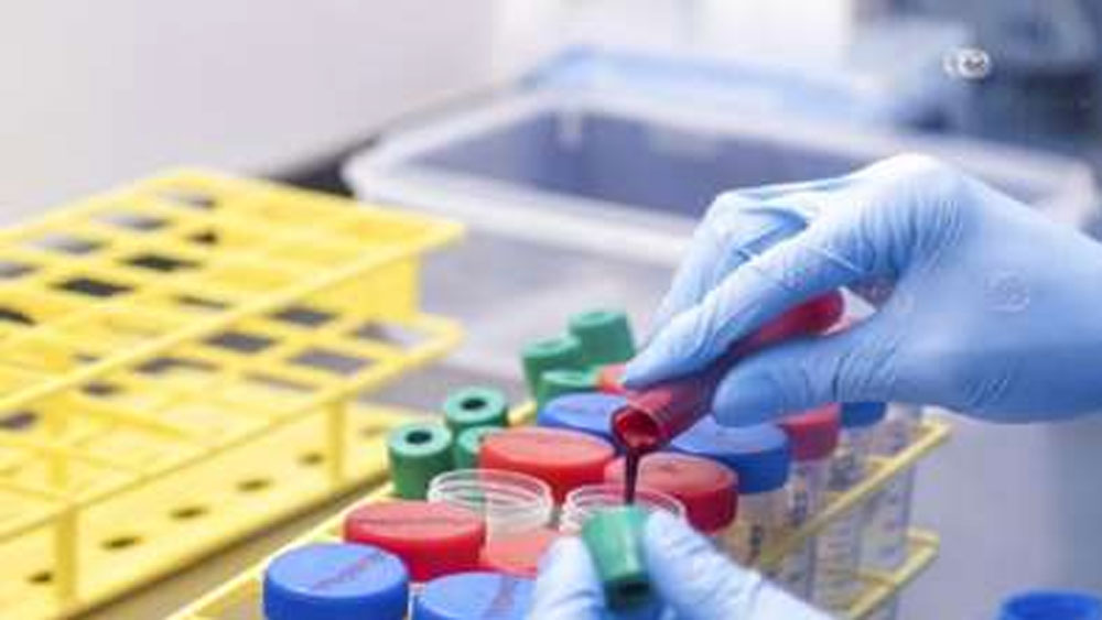 মাত্র ৩০ বছরে সিরাম ইনস্টিটিউটের সিইও-র দায়িত্ব নিয়েছেন আদার পুনাওয়ালা। কোভিড-টিকা নিয়ে চর্চায় বারবারই এখন তাঁর কথা সংবাদে উঠে আসছে। তবে কয়েক বছর আগেও এক বিষেষ কারণে শিরোনামে আসেন পুনাওয়ালারা। বিশাল টাকার বিনিময়ে ঐতিহ্যশালী লিঙ্কন হাউস ওরফে ওয়াঙ্কানার হাউস কিনে নেন তাঁরা। মূলত বসবাসের জন্যই প্রাসাদটি কিনেছিলেন।