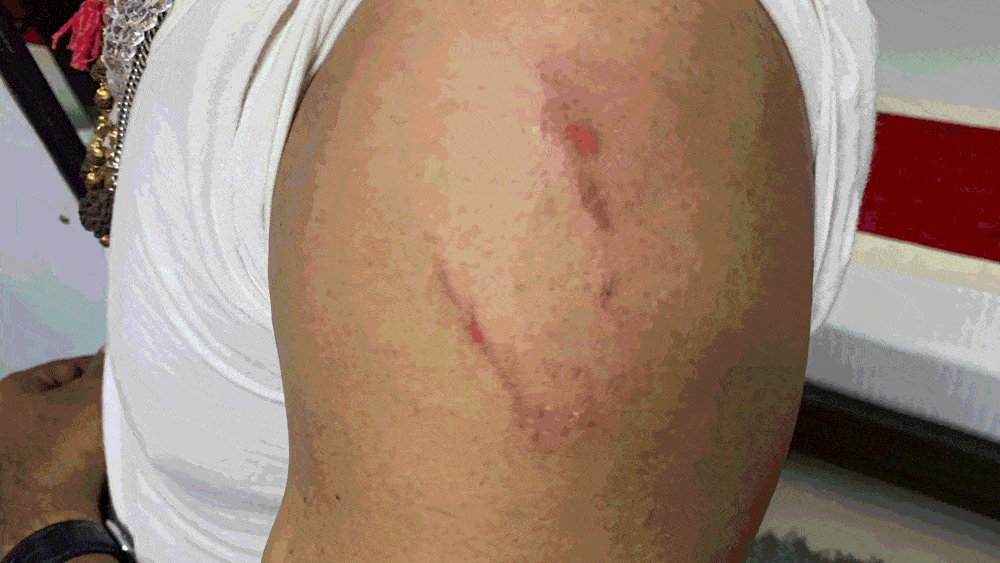  হামলার এক ডজন,  হাত ‘রগড়ে’ গেলেও  রক্ষা পেল দিলীপের পয়া নম্বরের এসইউভি