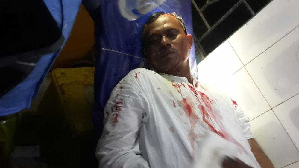 আহত তৃণমূল প্রার্থী গিরীন্দ্রনাথ বর্মন।