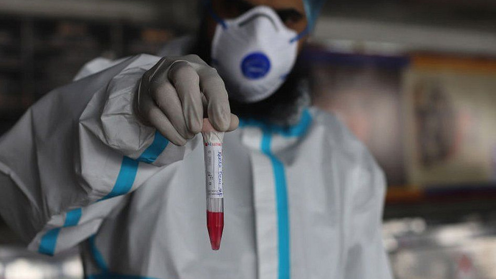 নতুন রোগীরা কোন কোন রূপের ভাইরাসে আক্রান্ত হচ্ছেন, তা জানতে সারা দেশের সঙ্গে এ রাজ্যেও প্রতি সপ্তাহে ‘জিনোম সিকোয়েন্সিং’ করা হচ্ছে। কিন্তু যে পরিমাণে হচ্ছে তাতে সন্তুষ্ট নন অনেকেই। 