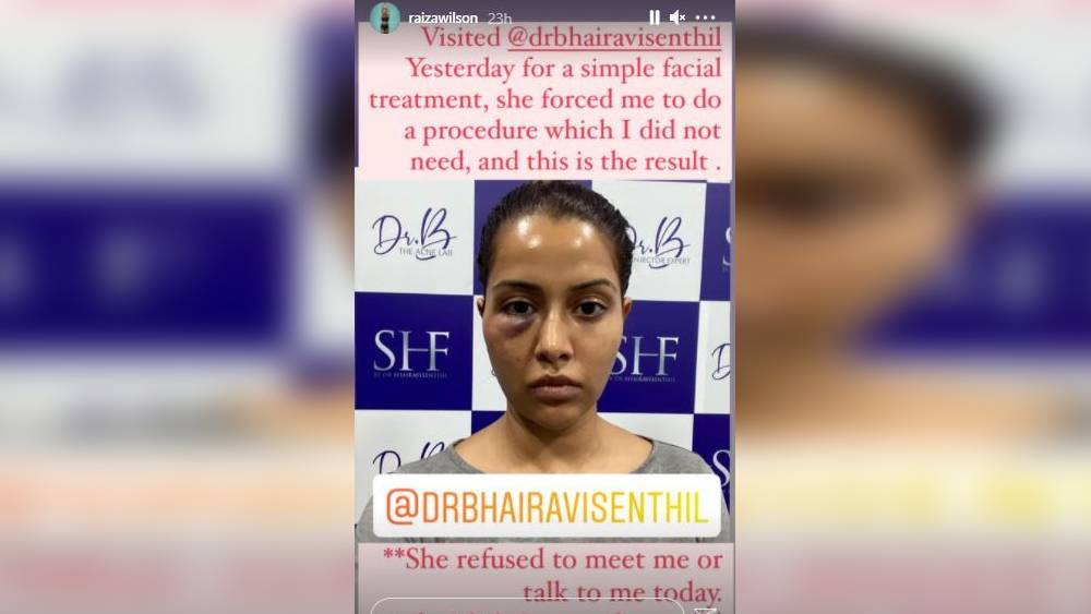 রাইজার পোস্ট