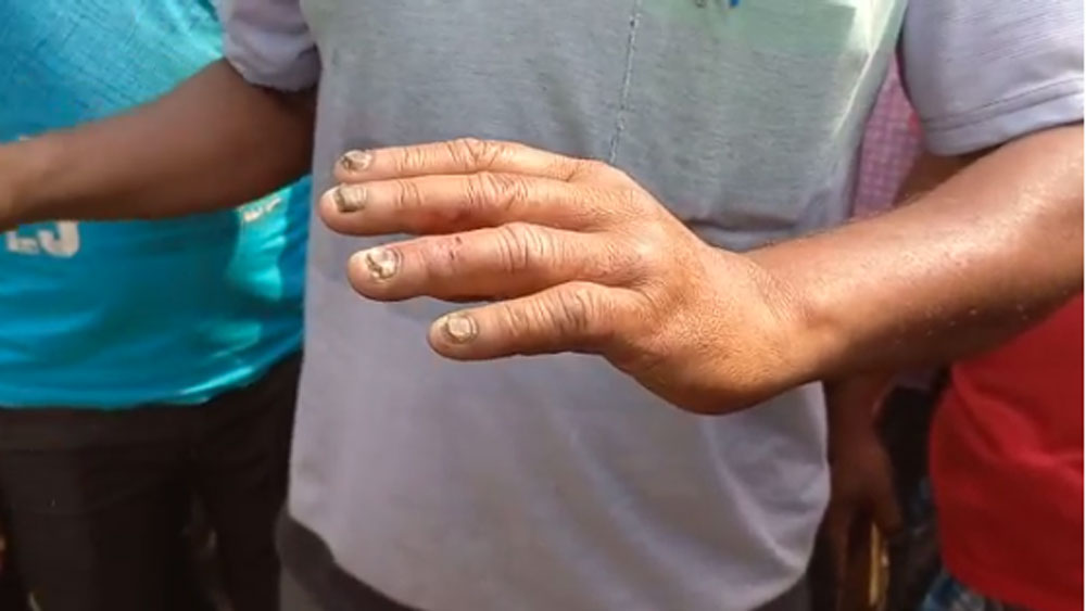 West Bengal Election 2021: TMC workers allegedly beaten by central force in Malda dgtld 