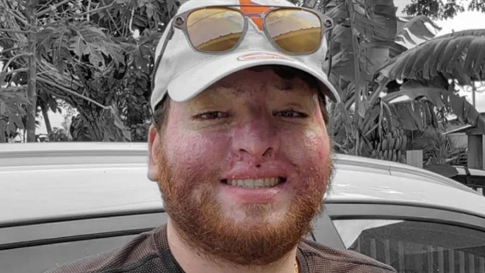 আর তার চেয়েও আশ্চর্যের এর পরের ঘটনাটি। চিকিৎসার জন্য ২০ লাখ ডলার ঋণের চিঠি তাঁর হাতে পৌঁছেছে। যা কী ভাবে শোধ করবেন বুঝে উঠতে পারছেন না অ্যালেক্সিস।