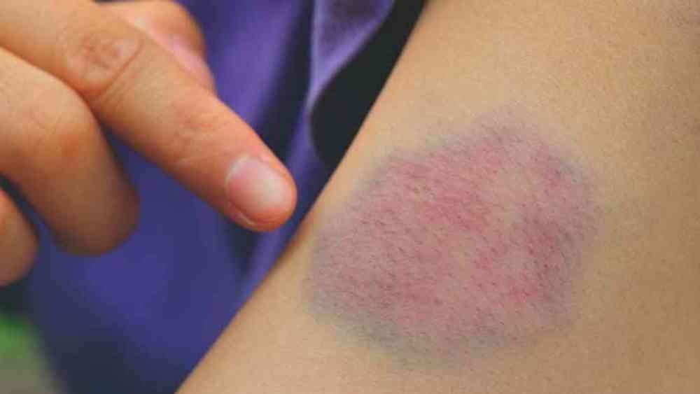 প্রতীকী ছবি।