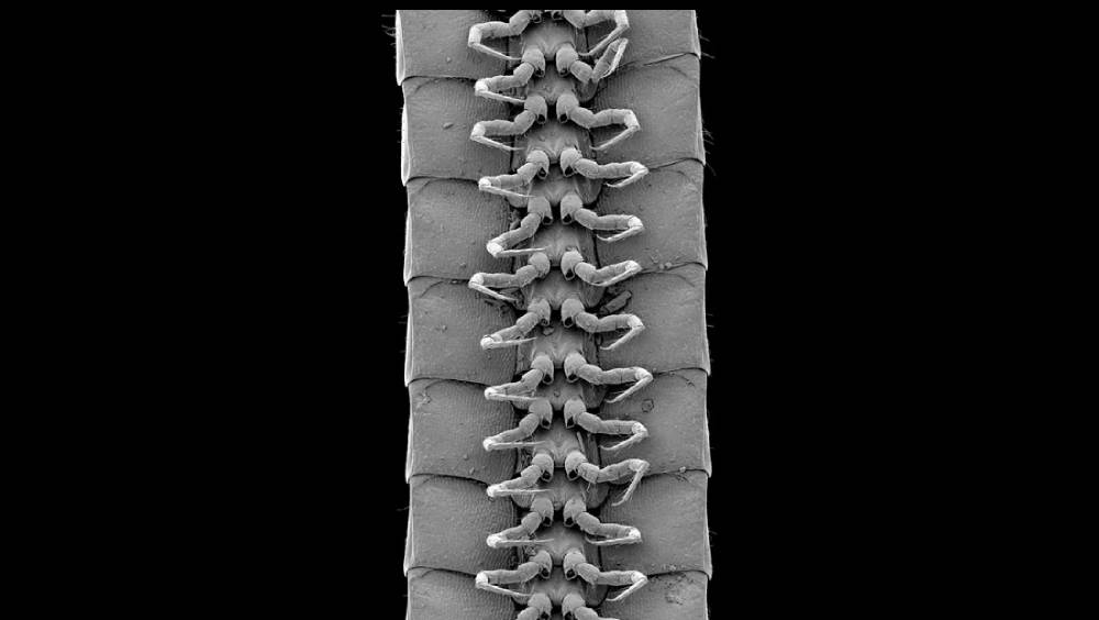 অণুবীক্ষণ যন্ত্রের নীচে সদ্য আবিষ্কৃত প্রাণীর পাগুলি। ছবি- সায়েন্টিফিক রিপোর্টস জার্নালের সৌজন্যে।