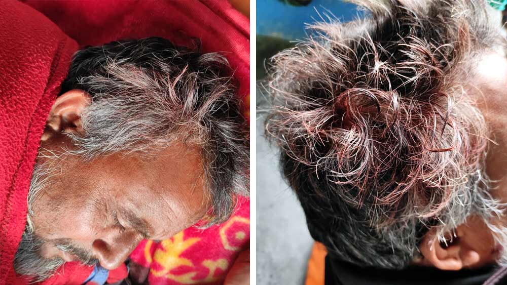 হামলায় হামিদুল মিয়াঁর মাথায় গুলি লাগে বলে অভিযোগ।