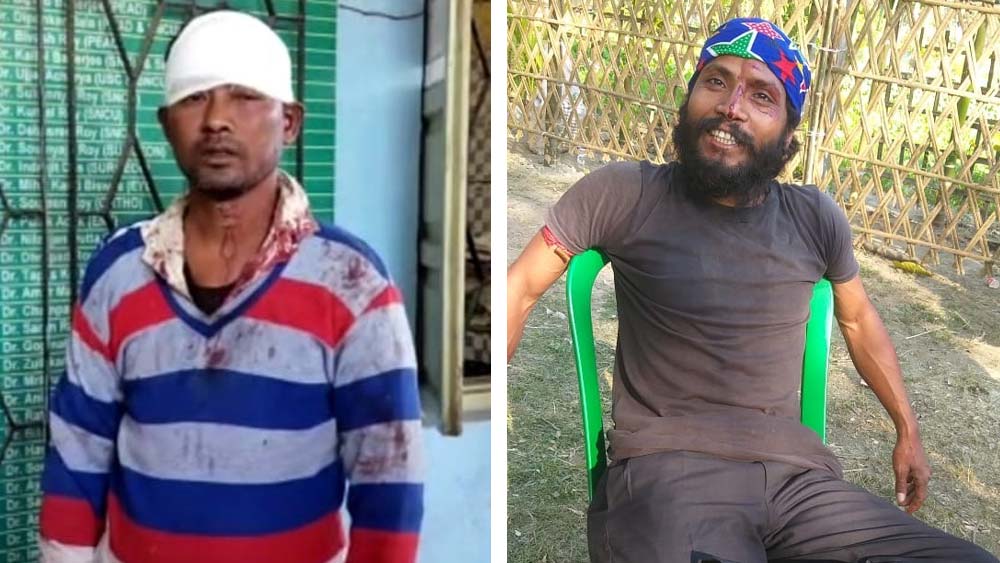 বাঁ দিকে জখম প্রভাতচন্দ্র অধিকারী ও ডান দিকে অভিযুক্ত সুশান্ত বর্মণ।