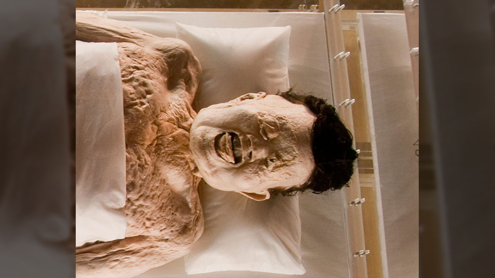 তাঁর দেহটিকে ময়নাতদন্তের জন্য পাঠানো হয়। তাঁর অঙ্গ-প্রত্যঙ্গগুলো ছিল খুব ভাল অবস্থায়। হুইয়ের মাথার চুল, চোখের পাতা তো প্রায় নিখুঁত ছিলই, শিরায় রক্তও ছিল। ময়নাতদন্ত করে বিজ্ঞানীরা তাঁর শিরায় জমাট রক্তের সন্ধান পান। এর থেকেই তাঁরা জানতে পারেন হুইয়ের মৃত্যু হৃদরোগের কারণে হয়েছিল।