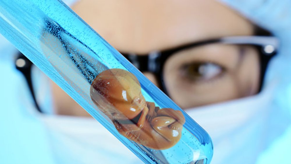 সাধারণত ইউক্রেনে সারেগেসির মাধ্যমে অন্তঃসত্ত্বা হওয়ার ন্যূনতম খরচ ২৫ হাজার ইউরো। ভারতীয় মূদ্রায় ২২ লক্ষ টাকা। তবে এই খরচ বাড়তে পারে ৭০ হাজার ইউরো পর্যন্ত, যা ভারতীয় মূদ্রায় ৬১ লক্ষ টাকার সমান। তবে ইউক্রেনের রাজধানী কিয়েভের একটি সারোগেসি ক্লিনিক 'বায়োটেক্সকম' জানাচ্ছে, দেশের অর্ধেক সারোগেসি প্রক্রিয়া ৩৯ হাজার ৯০০ ইউরো বা ৩৫.৩ লাখ টাকার মধ্যেই সম্পন্ন হয়ে যায়। 