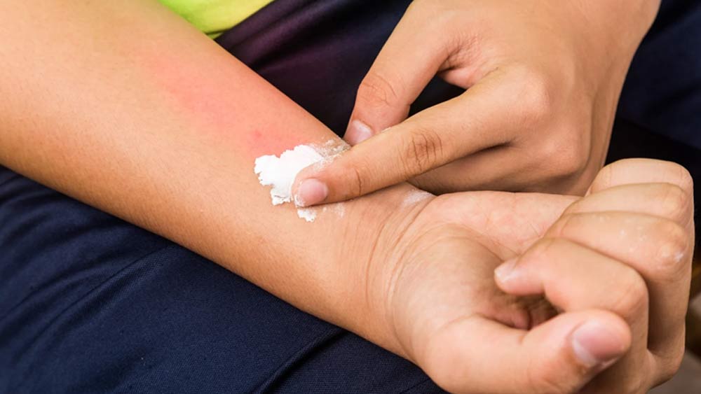 পোকা-মাকড় কামড়ানোর জ্বালা কিংবা যন্ত্রণা থেকে রেহাই পেতেও বেকিং সোডা লাগাতে পারেন। বাজার চলতি মলমেও সোডিয়াম বাইকার্বনেট-ই দেওয়া থাকে।