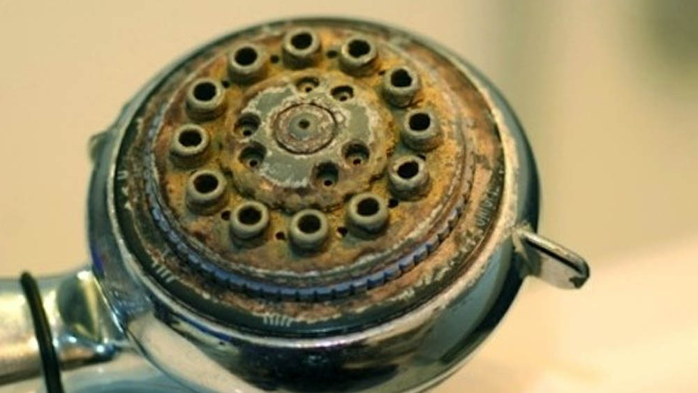 ঘরোয়া উপায়েই প্রতিকার হবে এই সমস্যার।