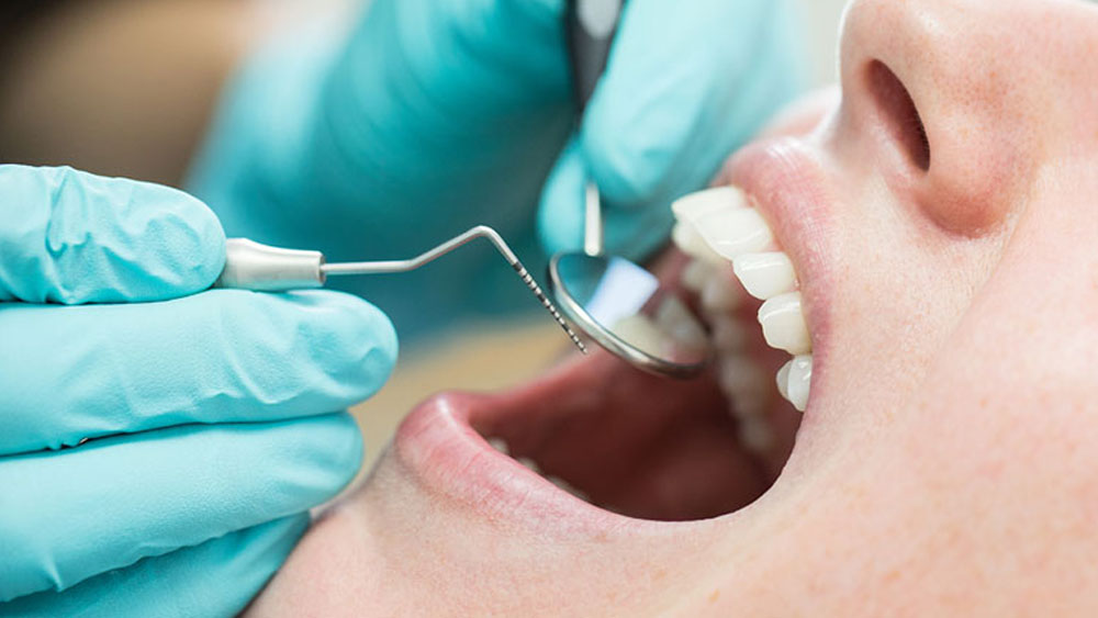 স্কেলিং করালে কি দাঁতের ক্ষতি হয়?