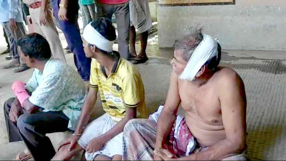 অন্য আহতেরা। 