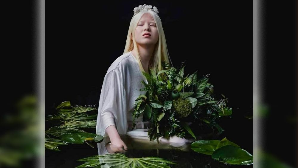 এই রোগে শরীর নিজের স্বাভাবিক রং হারায়। ত্বকের জরুরি উপাদান মেলানিনের অভাবে স্বাভাবিকত্ব হারায় ত্বক, চুল, চোখ। দৃষ্টিশক্তিতেও এর প্রভাব পড়ে। 