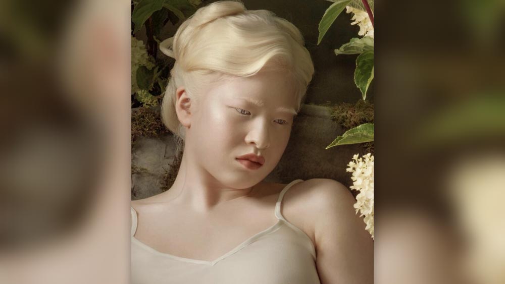 হুয়েই জানিয়েছেন, ফ্যাশন দুনিয়ায় দেখতে আলাদা হওয়া যে আসলে আশীর্বাদ তা এখন বুঝেছেন তিনি। 